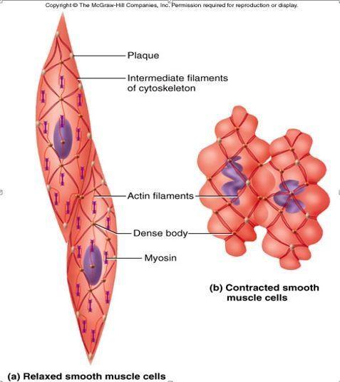 No sarcomeres Dense bodies on the membrane analogous to the Z lines Thin filaments (actin) are attached to dense