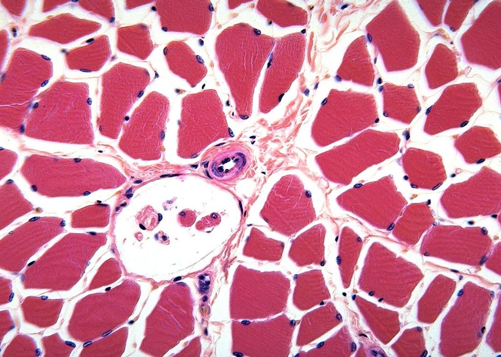 Connective tissue of skeletal muscle Black