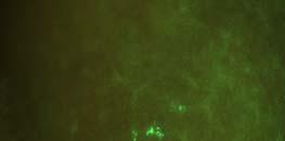 GFP-leled MDA-MB-231 (5,) cells