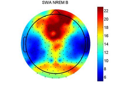 Figure : Absolute (left) SWA (1-4Hz) topography and spatially normalized (Zscore normalization, right) SWA topography for Group A (top row) and Group B (middle row).