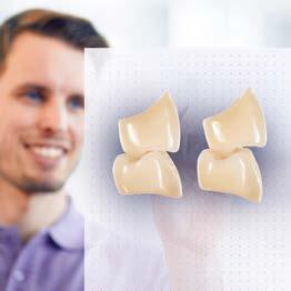 rapid tooth selection VITA MFT for simple,