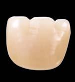 VITA MFT are denture teeth made of HC polymer for solid, standard