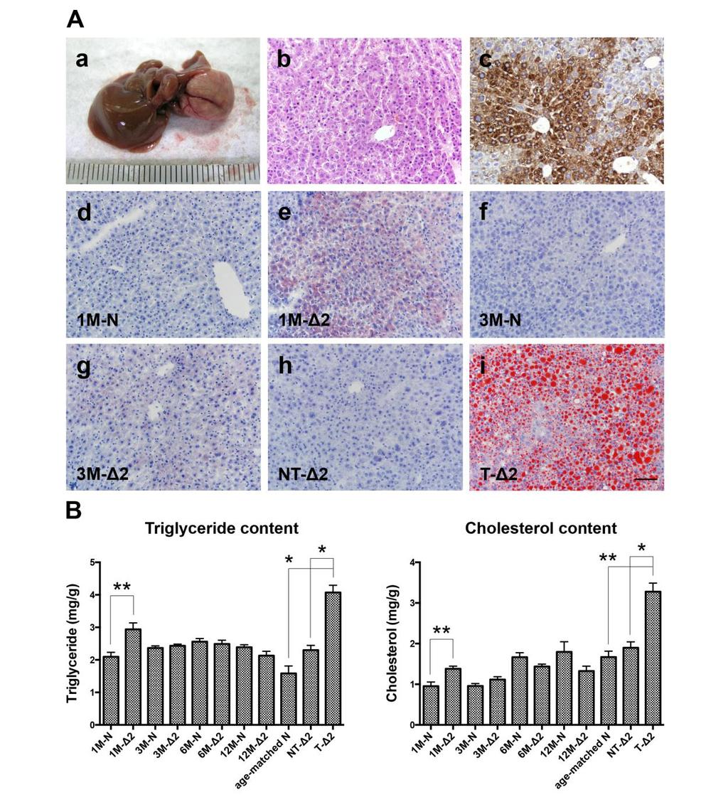 HBV pre-s2 mutant transgenic mice exhibited increased lipid accumulation in