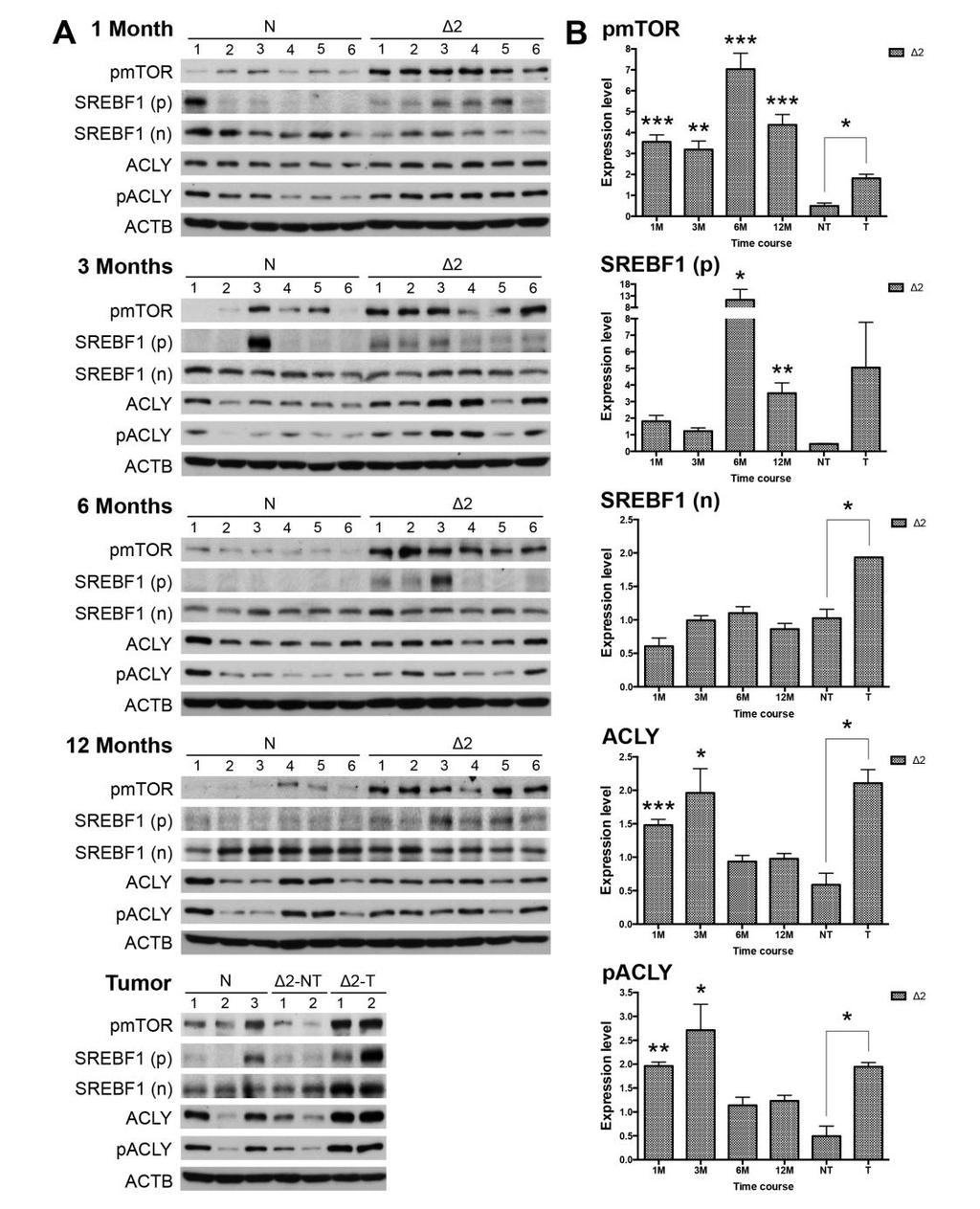 mtor, ACLY, and SREBF1 signals were chronologically activated in