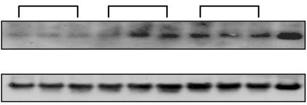A Romo1 β-actin Romo1 β-actin B Normal Pre-cancer Cancer RKO Romo1 1.4 1.1 1.2 2.