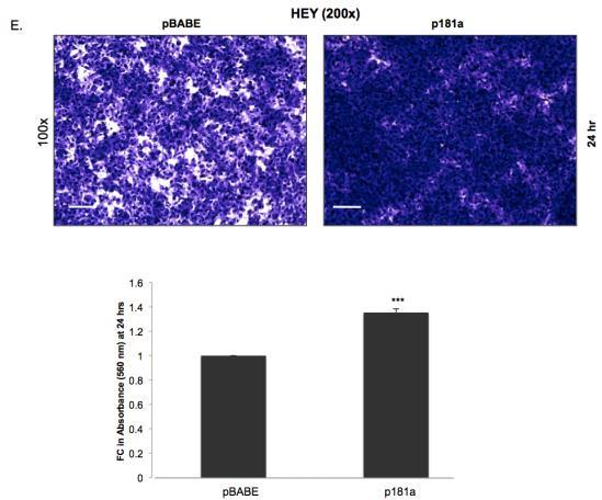 Supplementary Figure S5 Enhanced expression of mir-181a results in an EMT-like phenotype and increases cellular survival and migration in the HEY serous ovarian