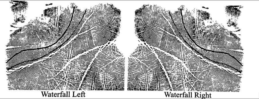 Figure 4. Outline of the waterfall displayed in the left and right hands (Ron Smith and Associates, 2002). The interdigital area of the palm is characterized by the number of deltas present.