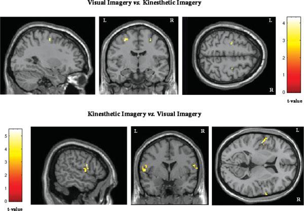 Figue 4. Activation maps of the lateal pemoto aea duing the visual and kinesthetic imagey conditions.