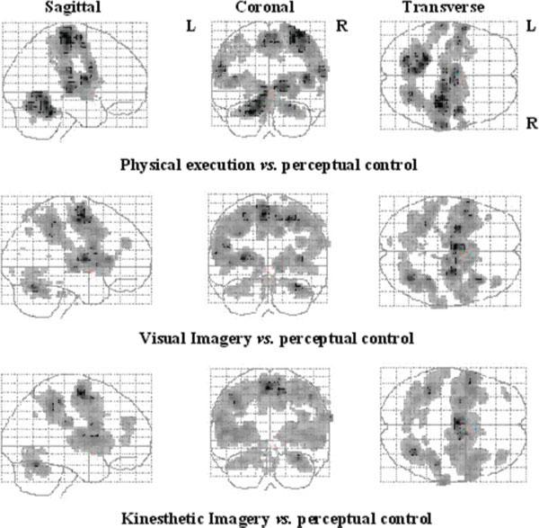 Neual Substates of Moto Imagey SPM activation maps compaing the diffeent expeimental conditions (physical execution, VI, and KI) with the peceptual contol condition.