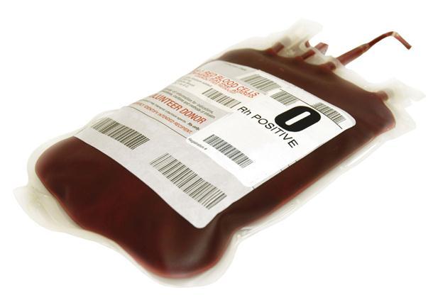 Supplemental treatment Blood transfusion considered for Hb < 100 g/l (ideal threshold for transfusion unknown) Optimize