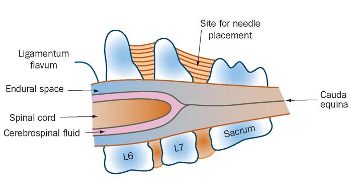 Figure 1. Anatomy of the lumbosacral region. Figure 2.