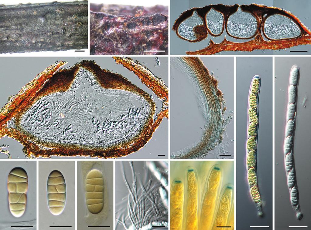 93 K. Tanaka et al.: Phylogeny of Discosia and Seimatosporium Adisciso tricellulare (Okane, Nakagiri & Tad. Ito) Kaz. Tanaka, Okane & Hosoya, comb. nov. MycoBank MB519745; Fig. 5, 7g, h Anamorph.