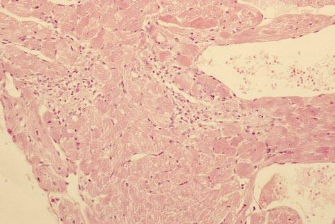 been described in the liver and kidneys of rats [49], albeit not in rabbits [37]. Also in patients, glycine 1.5% has been associated Glycine 1.1% with subacute eects on the myocardium.
