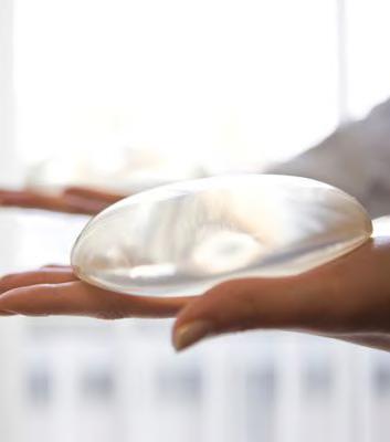 Breast Implant Quality Nowadays, implants are designed to last a lifetime, which means that they do not have to be replaced on a regular basis.