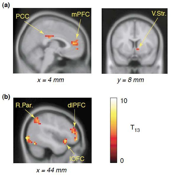 For humans on the order of months rather than seconds Immediate reward actively engage the ventral striatum, as well as