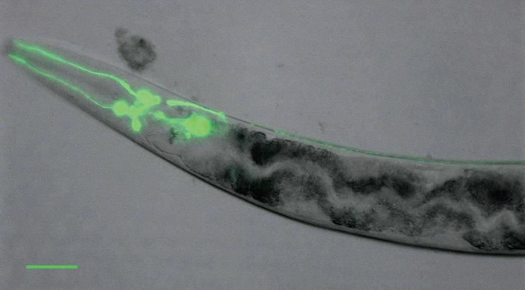Pdat-1: GFP (green fluorescent protein) expression in the DAergic head neurons in C. elegans. Bar scale represents 50 μm.