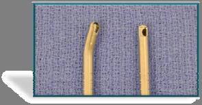 Microdebrider Historical background: In the early 1990s, used in endoscopic sinus surgery.