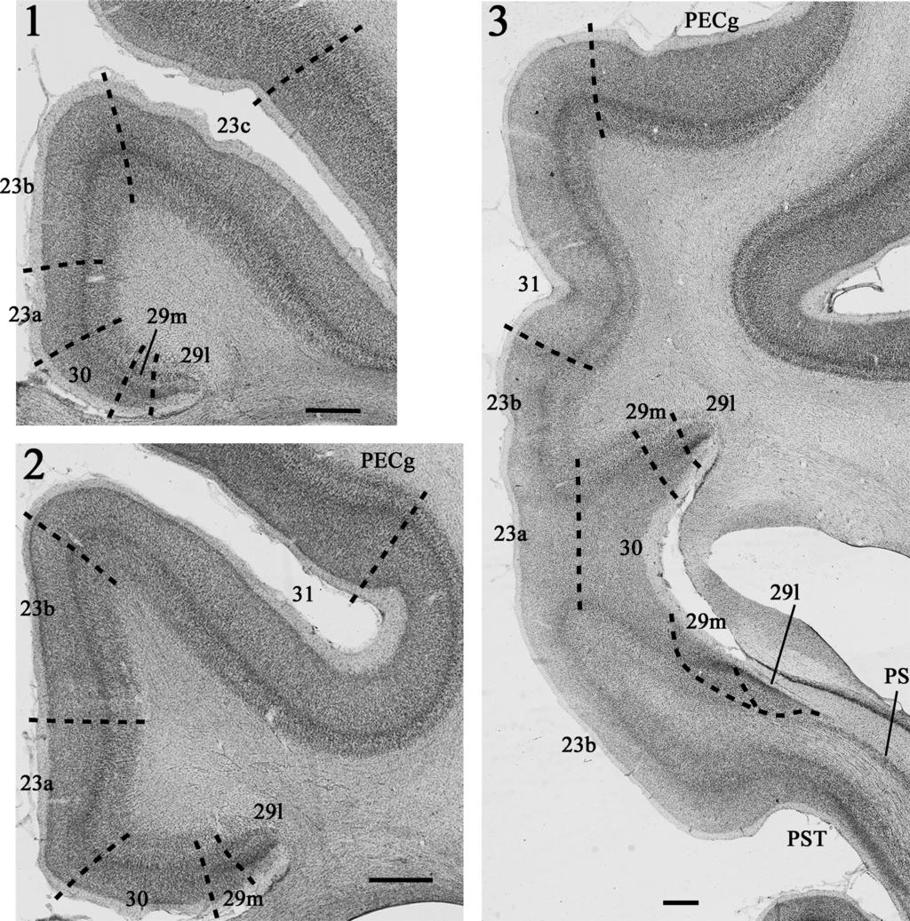 110 J. P. Aggleton et al. Nomenclature The anterior thalamic nuclei in macaque monkeys comprise three major nuclei: anterior medial, anterior ventral and anterior dorsal.