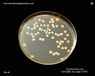 GAS) Enterobacteriaceae e.g.