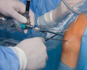 Learning Objectives Recognize and diagnose non-arthritic knee conditions Identify treatment options for knee preservation Describe current indications for knee arthroscopy Interpret evidence-based