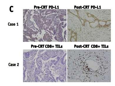 CRT rectal cancer induction of CD8+