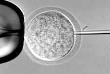 An ovum is retained, placing the first polar body at 12:00 or 6:00 position, using the holding pipette. 6. The sperm is released, and only the zona pellucida is 3 penetrated by several piezopulses (intensity: 2, speed: 1) (Photo 3).