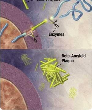 Amyloid beta (Aβ) are peptides of 36 43 amino acids that are processed from the Amyloid precursor protein Aβs are the main component of amyloid plaques -
