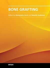 Bone Grafting Edited by Dr Alessandro Zorzi ISBN 978-953-51-0324-0 Hard cover, 214 pages Publisher InTech Published online 21, March, 2012 Published in print edition March, 2012 Bone grafting is the