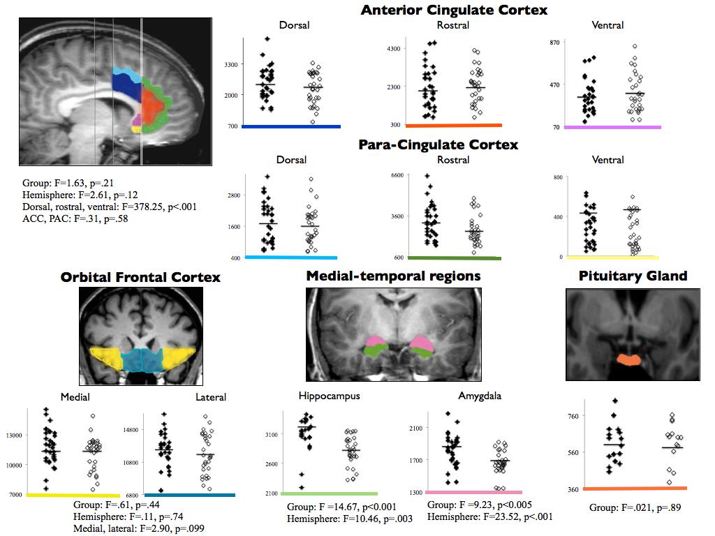 Figure 1: Regional brain volumes in heavy cannabis users (white) and