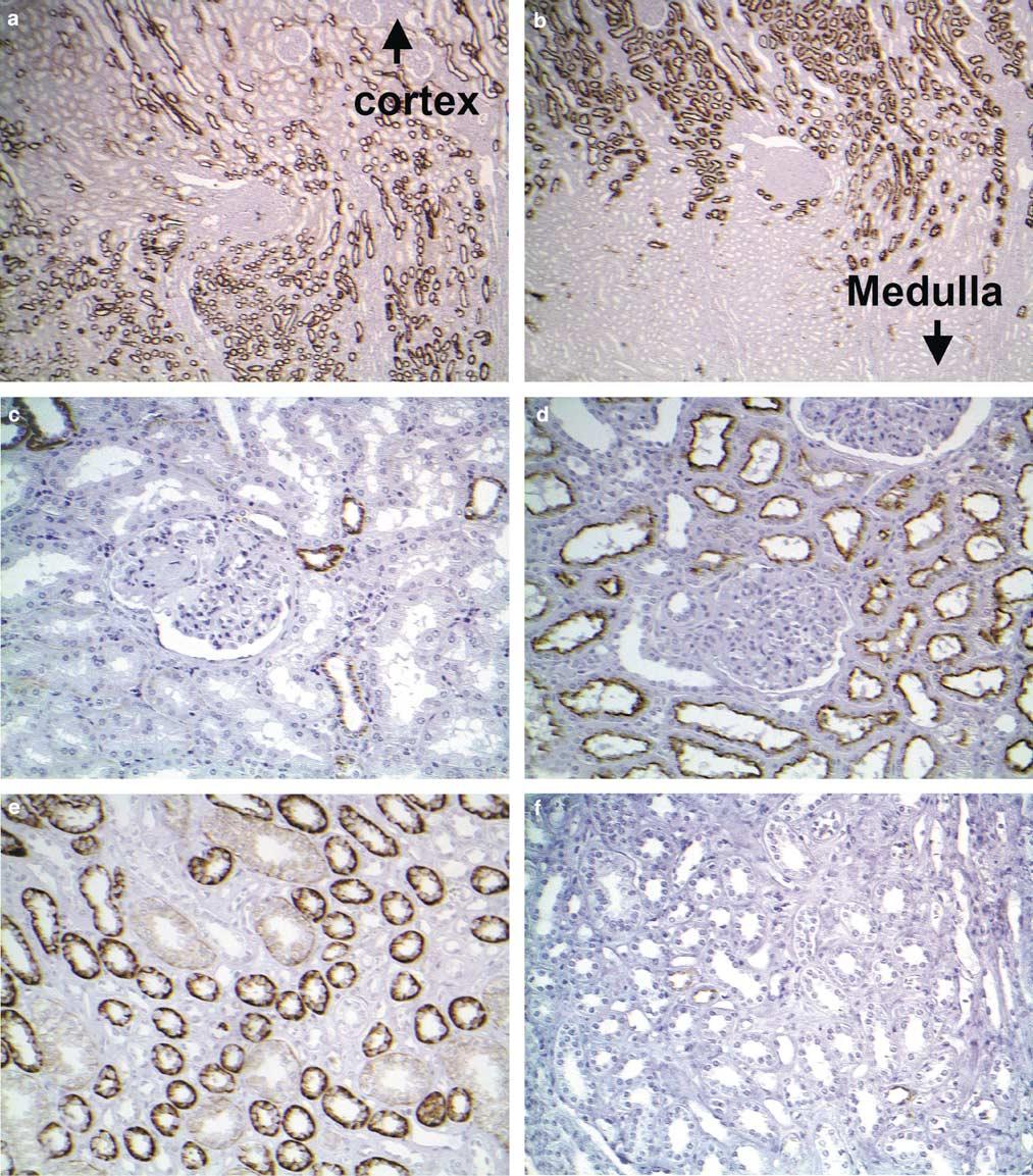 Kidney-specific cadherin in renal neoplasms 935 Figure 1 Staining of Ksp-cadherin (a, c, and e) and RCC marker (b, d, and f) in normal kidney (consecutive sections).