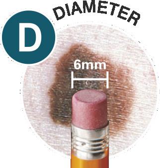 a single shade of brown or black D-iameter - larger than 6 mm Did