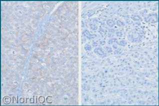 uterine cervix NordiQC runs for HER2 IHC CK7 18 Optimal
