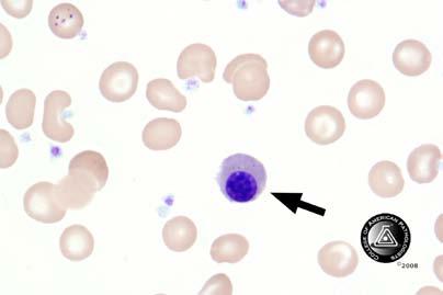 Blood Cell Identification Graded BCP-13 Nucleated red cell, normal or 33 100.0 5292 97.0 Good abnormal morphology Normoblast, any stage - - 145 2.