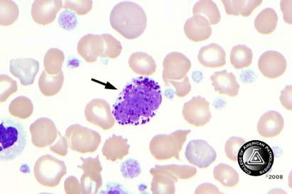 Blood Cell Identification Ungraded BCP-17 Basophil, any stage 26 100.0 5291 99.2 Educational The cell indicated by the arrow is a basophil as correctly identified by 100.0% of referees and 99.