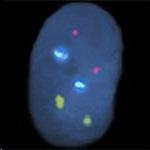 Chromosomes are then isolated from the nucleus, placed on a slide and stained.