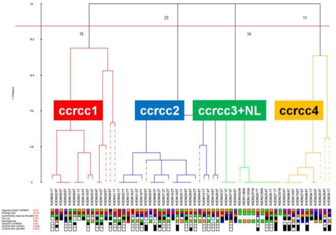 Molecular subtypes of clear cell RCC are associated with sunitinib response in the metastatic setting ccrcc1/ccrcc4