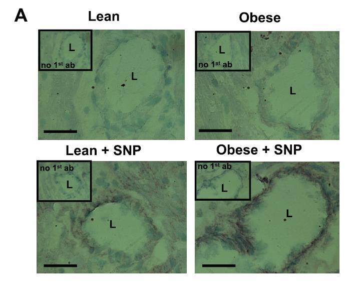 26 Immonocytochemistry. Basal and SNP-stimulated cgmp immunoreactivity were detected in native coronary arteriolar section in lean and obese rats.