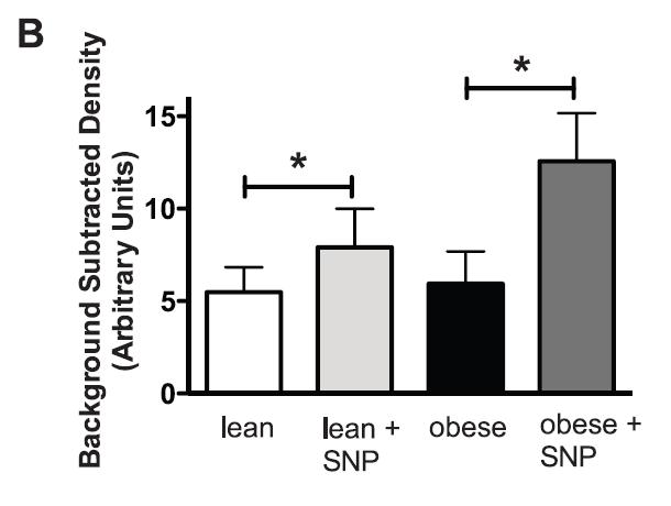 We have found that SNP-stimulated cgmp immunoreactivity was increased in coronary arterioles of lean and obese rats, and the enhancement found to be greater in coronary arterioles of obese rats