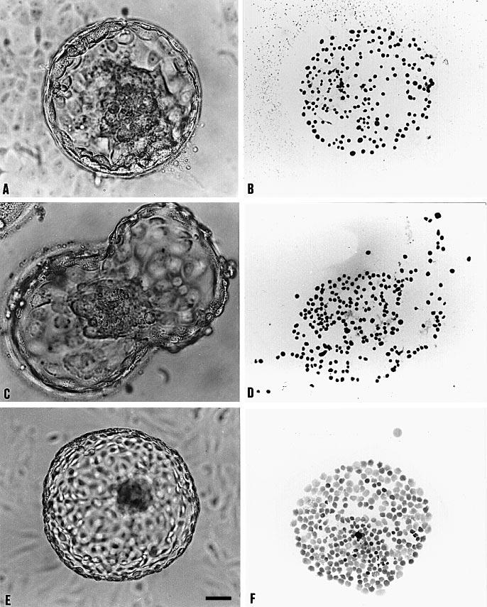 C-Y.Fong and A.Bongso Figure 2. Good day 7 blastocysts (panels A, C, E) with corresponding total cell numbers (TCN) observed in both in-vitro systems. For TCN analysis, each embryo was exposed to 0.