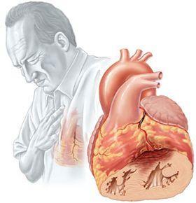 testosterone & heart Is testosterone administration associated with incidence of composite CV events? BMC Med. 2013; 11: 108.