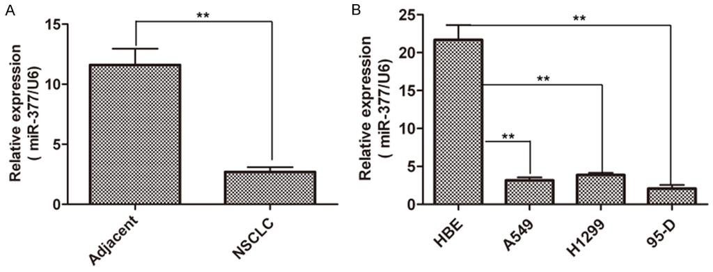 Figure 1. The comparison of mir-377 expression in normal lung and NSCLC tissues and cells. A. mir-377 was highly expressed in normal lung tissues, but lowly expressed in NSCLC tissues. B.