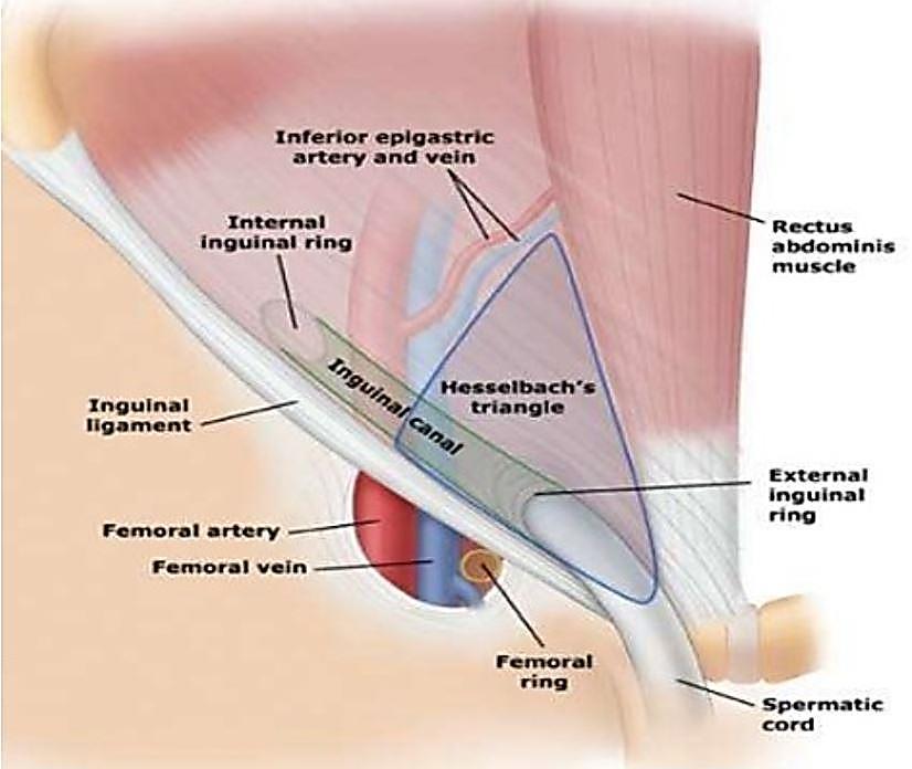 Inguinal Canal Anatomy Deep and superficial rings Females Round ligament of Uterus Males Spermatic cord Testicular artery and