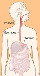 Gastroesophageal Reflux Disease: Introduction Gastroesophageal reflux is the involuntary movement of gastric contents to the esophagus.