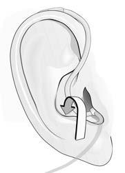 USER GUIDE MINIRITE 15 B C Never insert the speaker in the ear canal without the dome attached. Do not force the speaker too deeply into your ear canal.