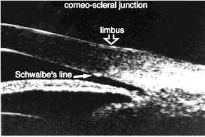The Corneoscleral junction: The corneoscleral junction can be differentiated because of the lower internal