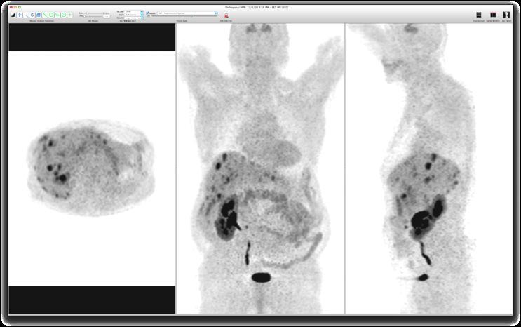 New tracers in PET imaging 18 F -