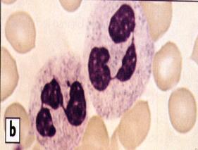 Neutrophils Banded neutrophil (Band) Less mature Polymorphonuclearcyte (Poly) Also called segmented neutrophil (Seg) Poly = Seg = Neutrophil (mature) 29 30 Granulocyte Colony-Stimulating Factors