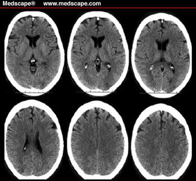 of the brain Good for identifying lesions