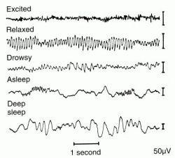 Alpha waves (8-13 Hz) Theta waves(4-8 Hz) Delta