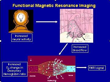 Neuroimaging Functional Magnetic